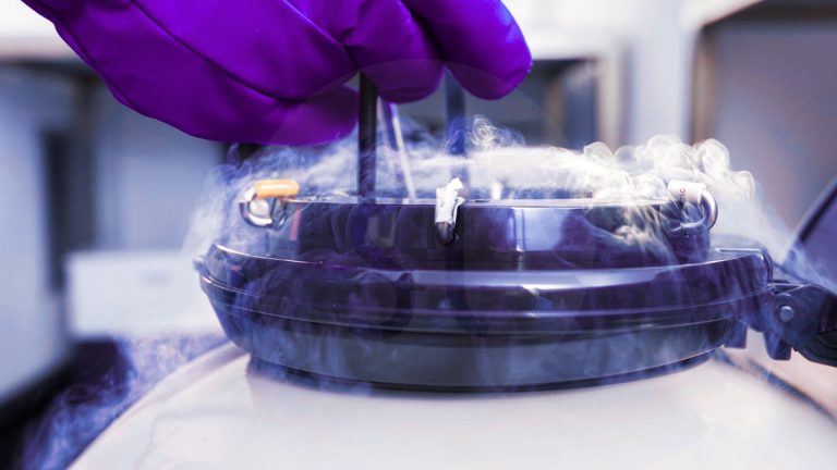 Sperm Freezing Sperm Cryopreservation