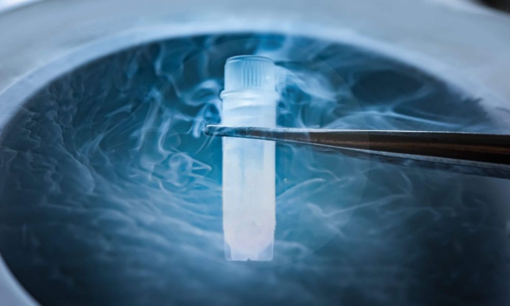 Sperm Freezing Sperm Cryopreservation