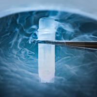 Sperm Freezing Sperm Cryopreservation