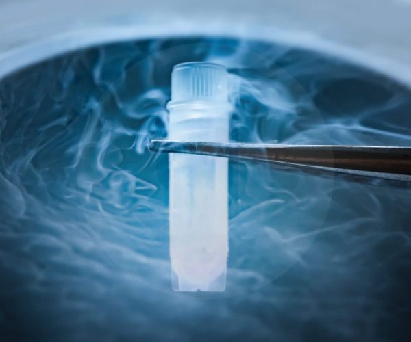 Sperm Freezing Sperm Cryopreservation