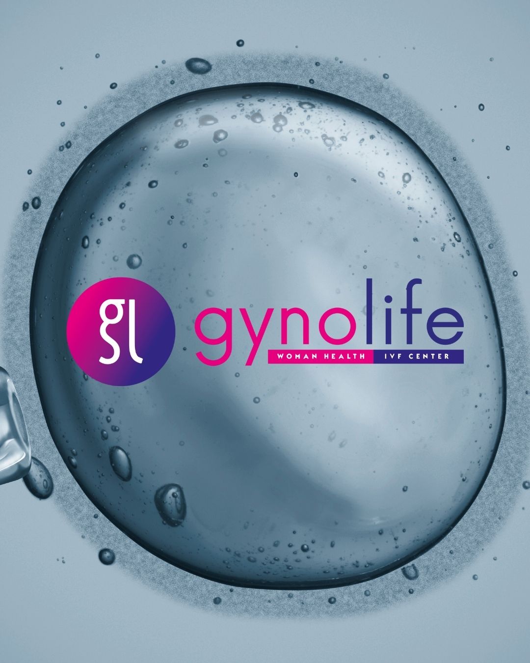 ivf плодородие Кипър